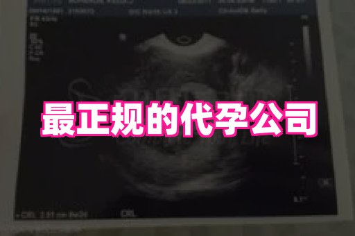 长春助孕网 4